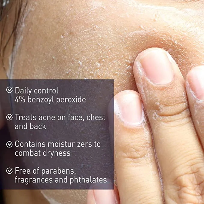(US Import) PanOxyl Antimicrobial Acne Creamy Wash, 4% Benzoyl Peroxide, 6 Ounce